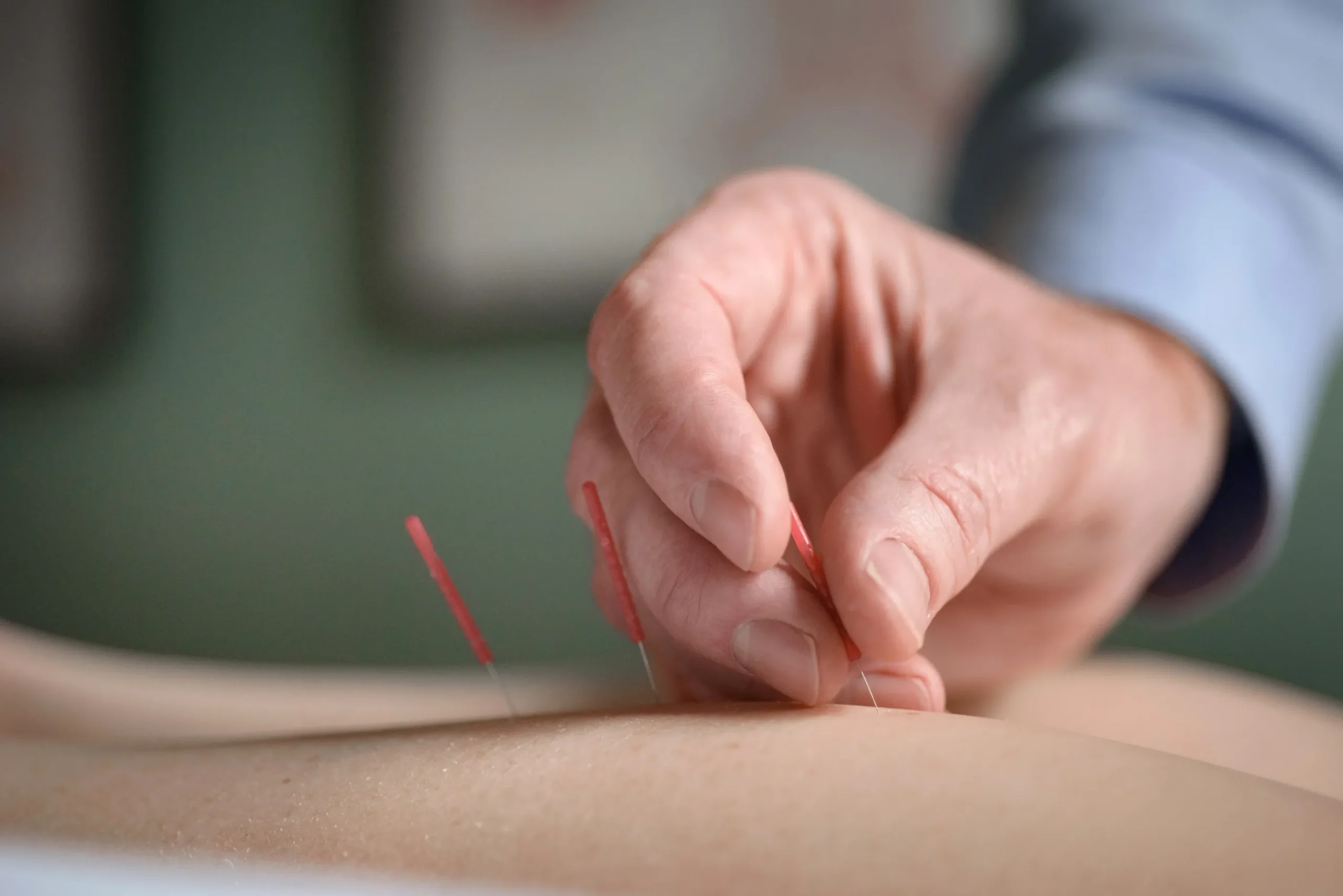 TCM & Acupuncture